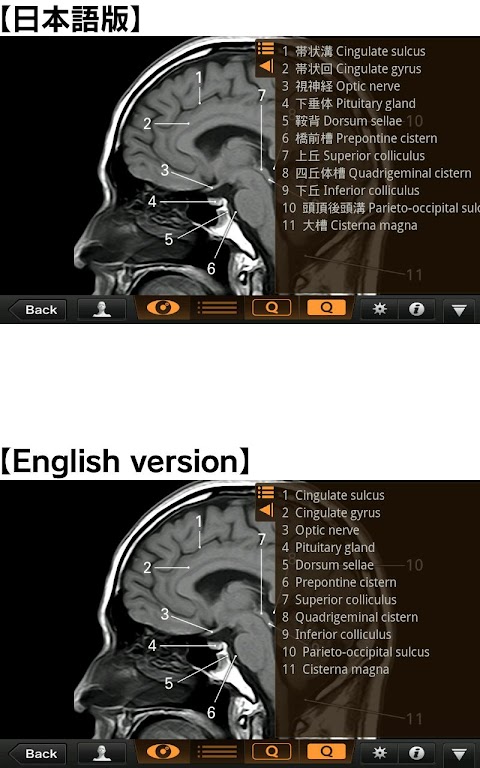 CT・MRI解体新書のおすすめ画像3