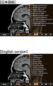 Interactive CT and MRI Anatomy