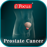 Prostate Cancer-An Overview icon