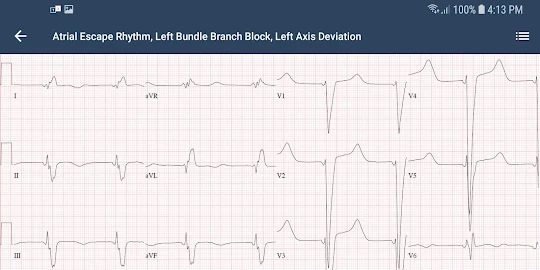 ECG Guide by QxMD