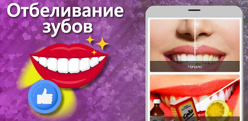 Отбеливание зубов