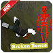 Mod Broken Bones Helper Unofficiel