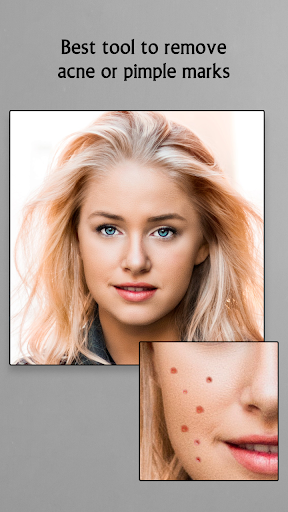 Remove Acne from Face Screen 2