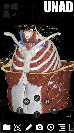 3Dissect Thorax UNAD Screen 2