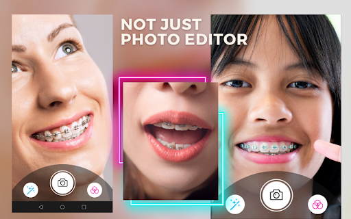 Behel Camera Beauty Brace Screen 2