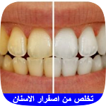 Cover Image of Baixar تخلص من اصفرار الاسنان  APK