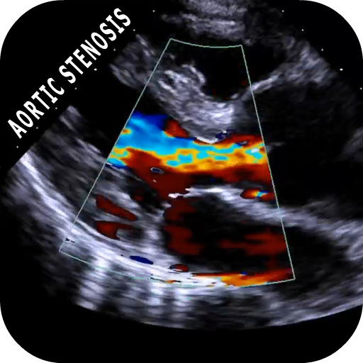 AORTIC STENOSIS PROTOCOL GUIDE logo
