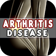 Arthritis: Causes, Diagnosis, and Treatment
