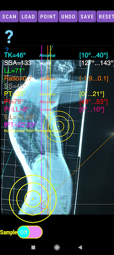 Sagittal Balance App screenshot 0