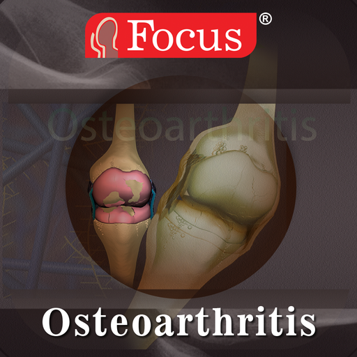 Osteoarthritis logo