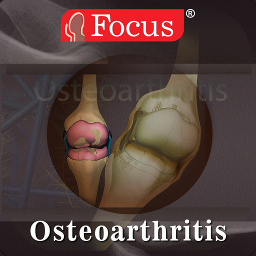 Osteoarthritis  Icon