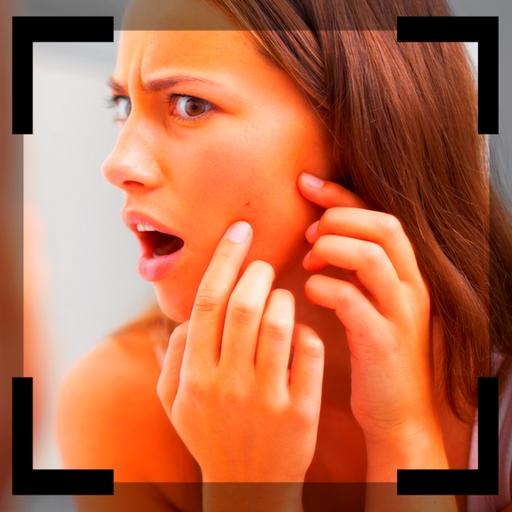 Get Rid Of Blackheads Naturall 1.0 Icon