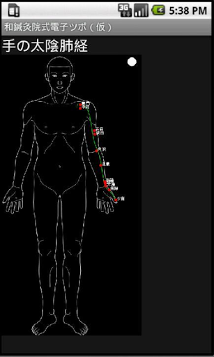 Acupuncture tentative