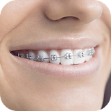Teeth Braces Photo Maker- Braces Camera Editor icon