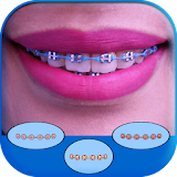 Real Braces Teeth Booth icon