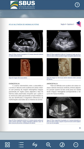 Atlas Multimídia de Anomalias Screen 3