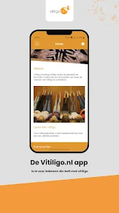Vitiligo.nl