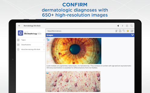 Dermatology DDx Captura de pantalla