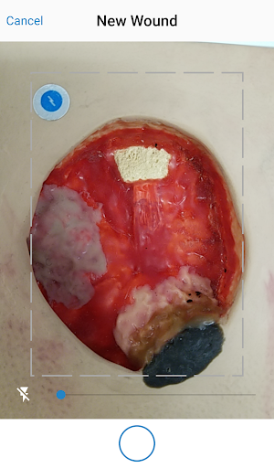 Swift Skin and Wound Screen 3