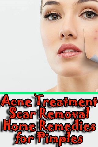 Remedies for Pimples, Acne Tre Screen 2