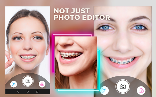 Behel Camera Beauty Brace Screen 3