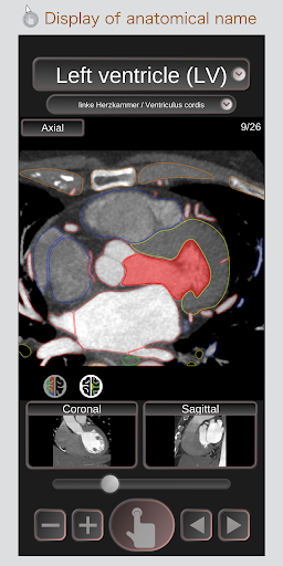 Android application CT Passport Heart / sectional screenshort