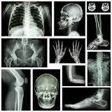 Medical X-RAY Interpretations with over 120+ cases icon