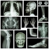 Medical X-RAY Interpretations with over 120+ cases