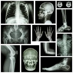 Las mejores aplicaciones de rayos X para descargar gratis