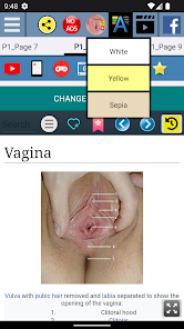 Hymen Anatomy 8