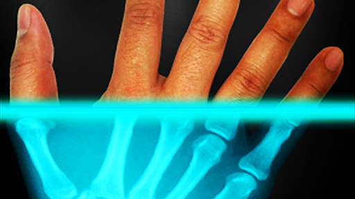 Android application XRAY filter for images screenshort