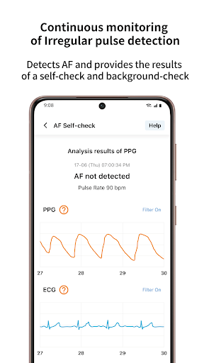 CART, CardioTracker Screen 2