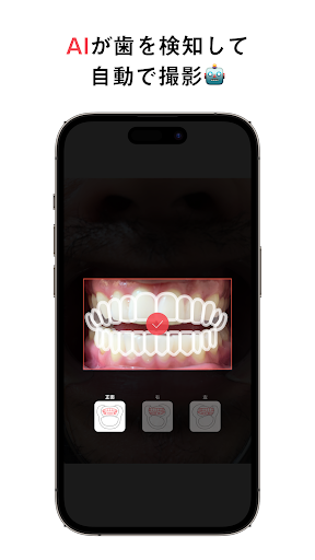Oh my teeth - Camera Screen 2