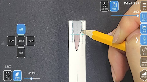 AR-D Morphology Screen 2