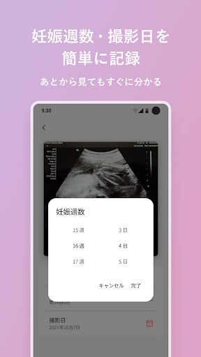 エコー写真　スキャンして簡単整理！ screenshot 1