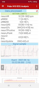 Captura de Pantalla 2 Polar H10 ECG analysis android