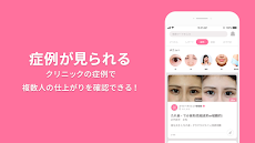 美容整形・美容医療の口コミ・予約アプリ 美容外科検索メイリーのおすすめ画像2