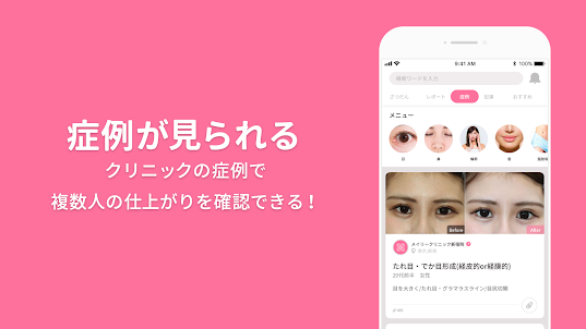 美容整形・美容医療の口コミ・予約アプリ 美容外科検索メイリー