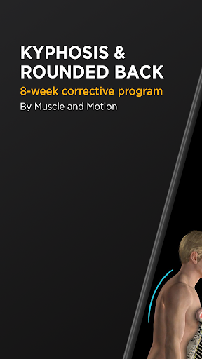 Screenshot of Kyphosis & Rounded Back by M&M
