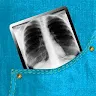 Easy Chest X-Ray