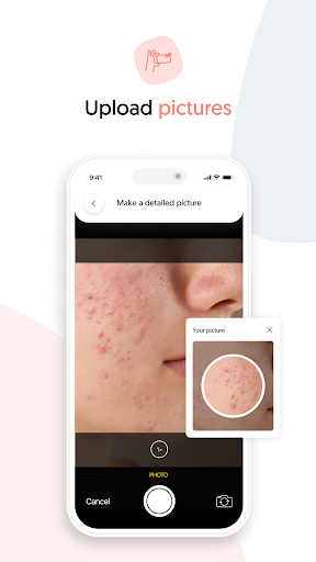 Skindr - Online Dermatologist Screen 2