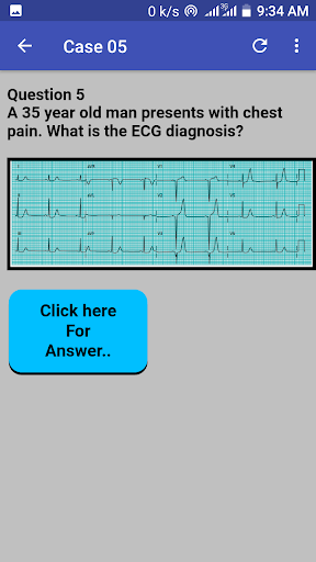 ECG Cases