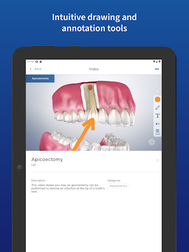 Patient Education Screen 2