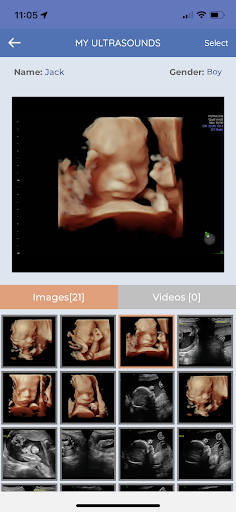 Bellybaloo Screen 3