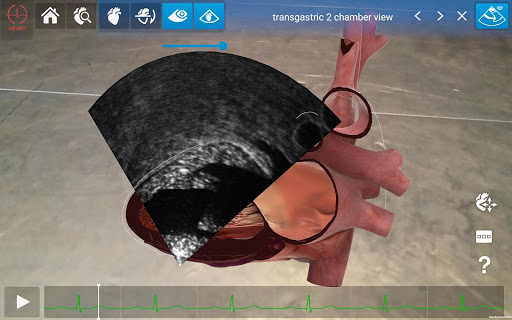 HeartWorks AR Screen 2