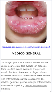 Screenshot 8 Model Dermatology–Skin Disease android
