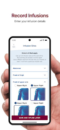 Hizentra App Screen 2