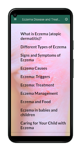 Eczema Disease and Treatment Screen 2
