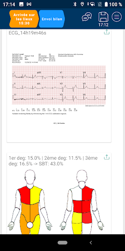BISOM MD Screen 3