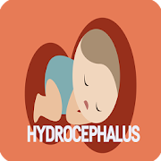 Hydrocephalus Disease